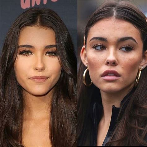 Madison Beer Plastic Surgery: Quotes, Before, After Photos